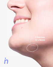 Cargar imagen en el visor de la galería, Parches para Granos, uso de noche - Nipskin®